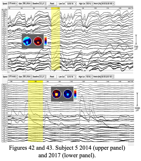 FIG42 43