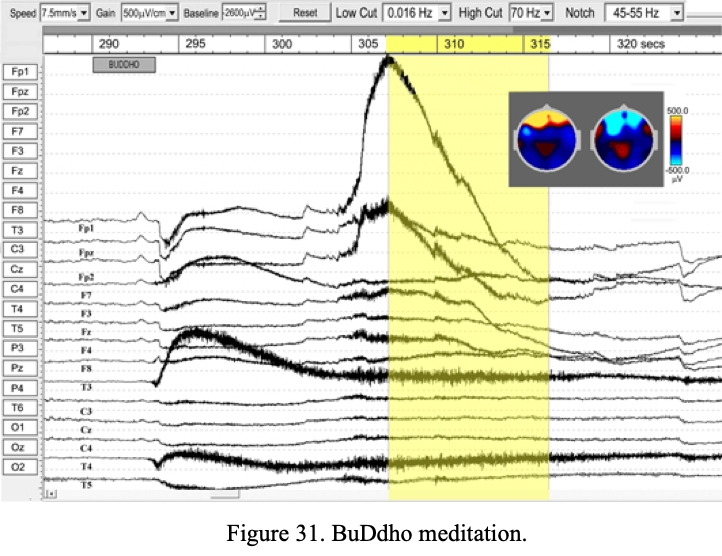 fig31