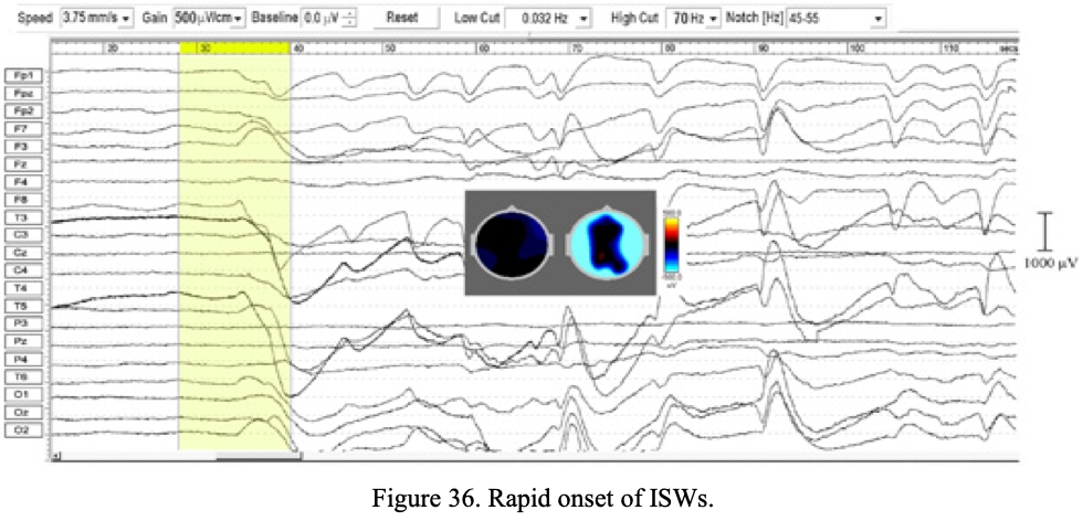 fig36