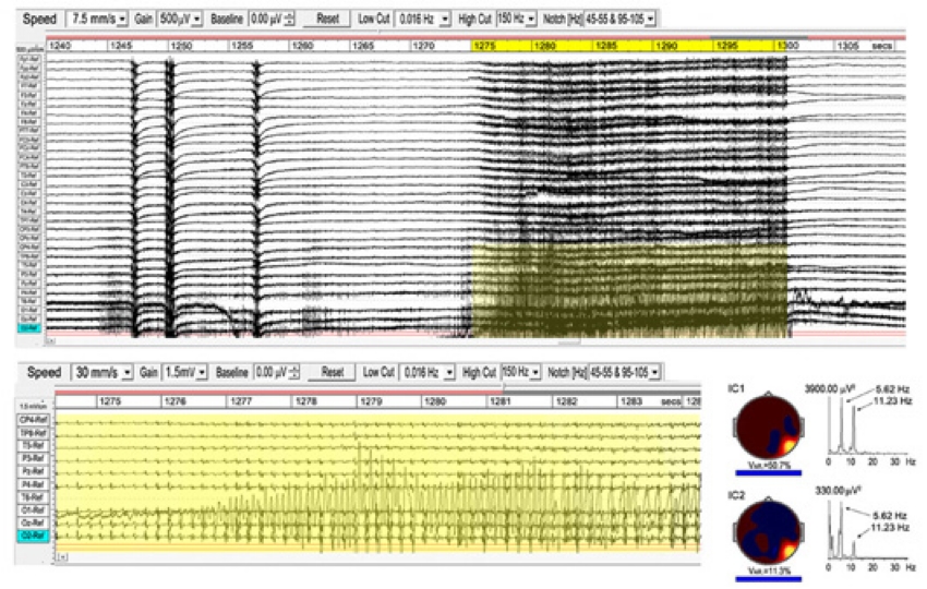 fig39